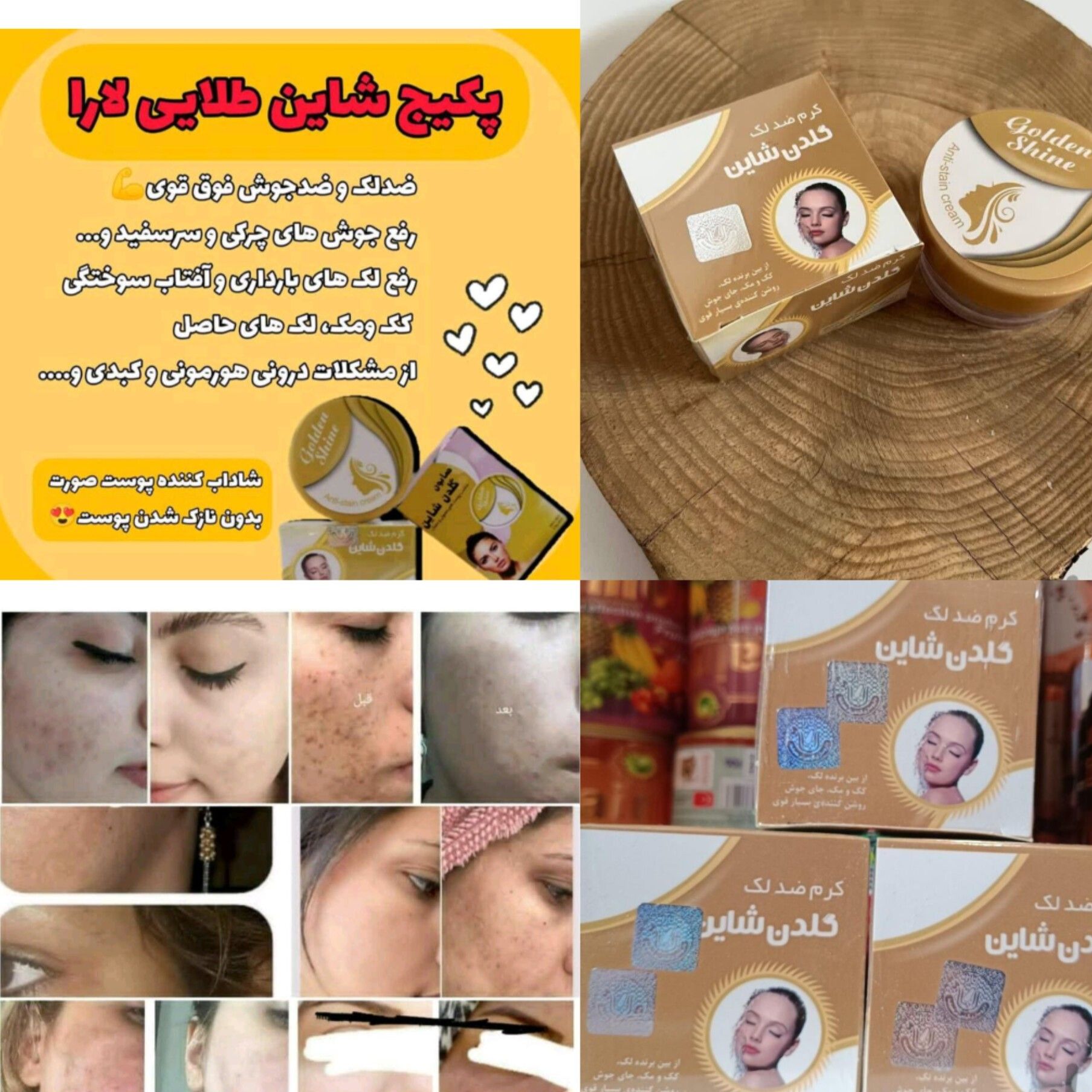 کرم ضد لک و روشن کننده پوست گلدن شاین از شرکت معتبر لارا  اصلی