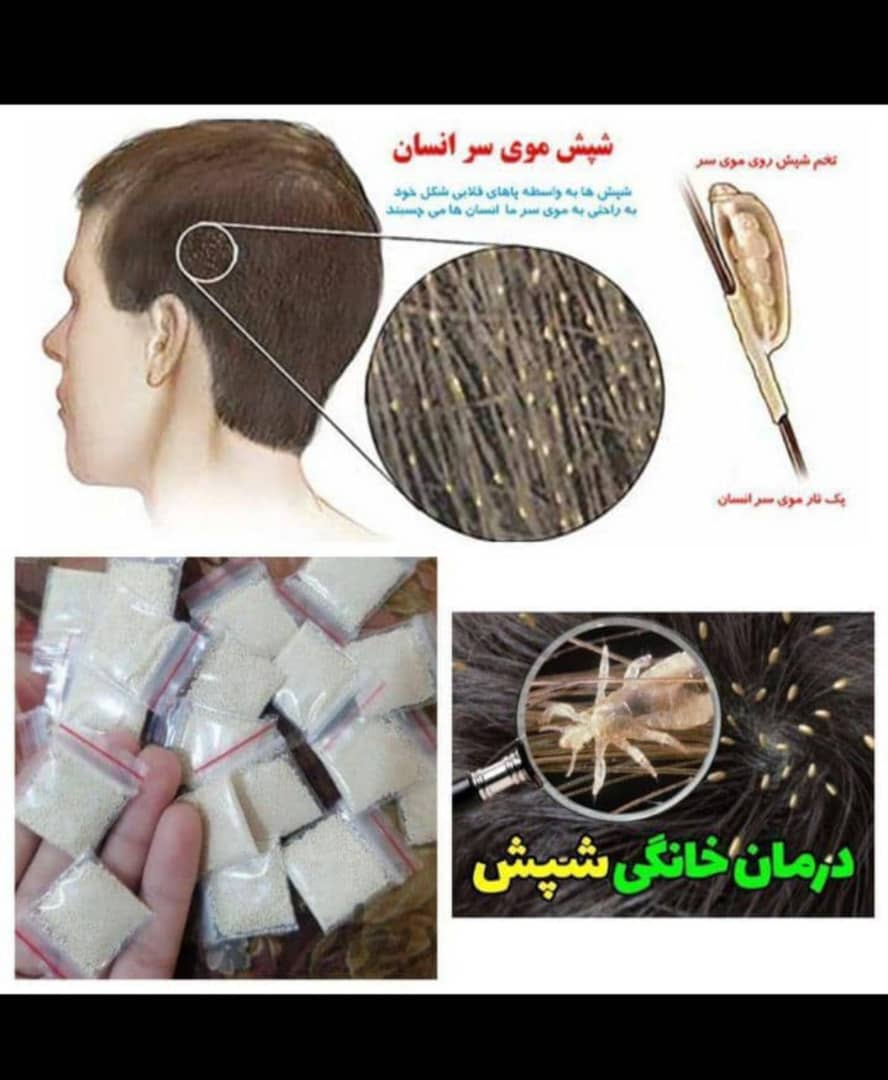 پودر شپش